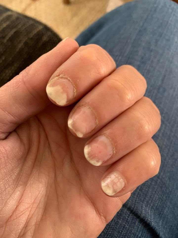 Nail Hygiene